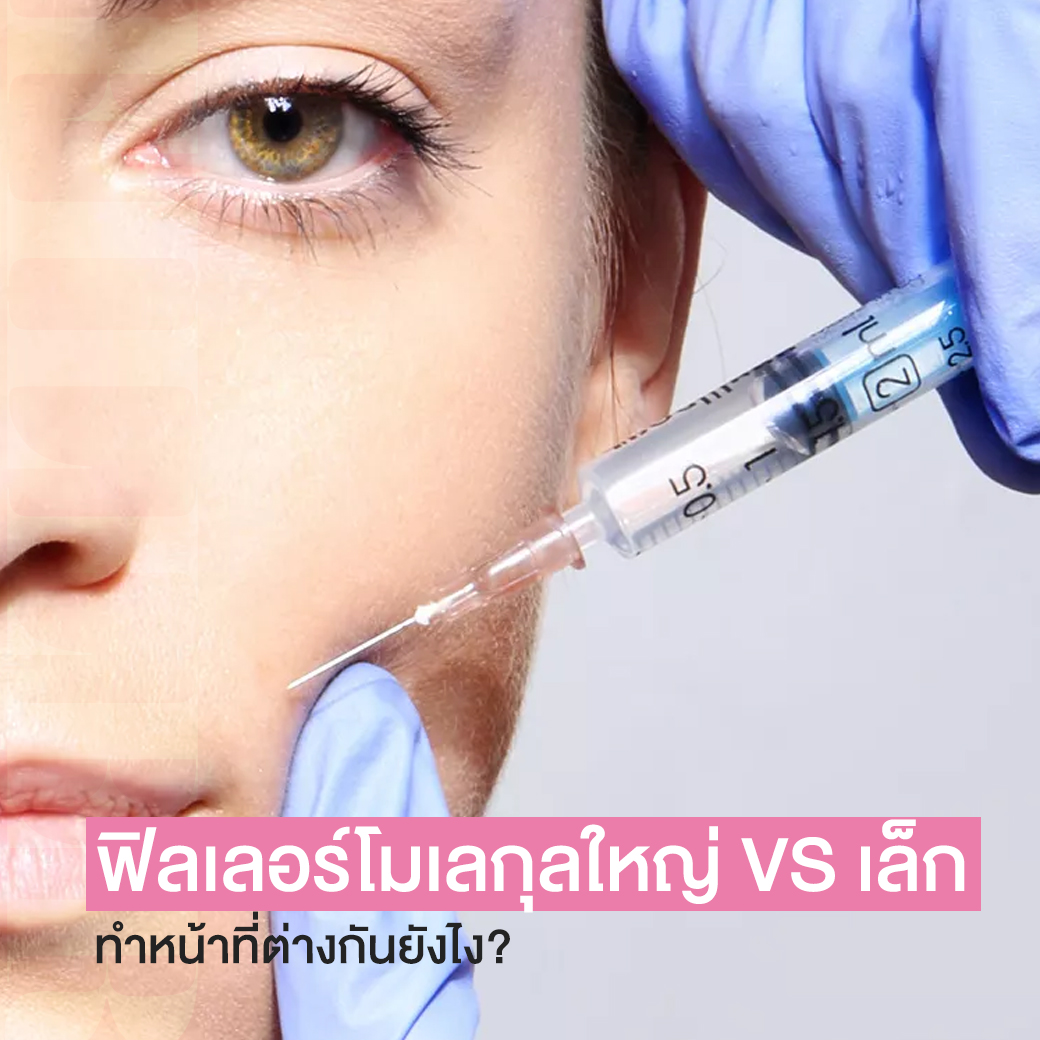 ฟิลเลอร์โมเลกุลใหญ่ VS เล็ก ทำหน้าที่ต่างกันยังไง ?