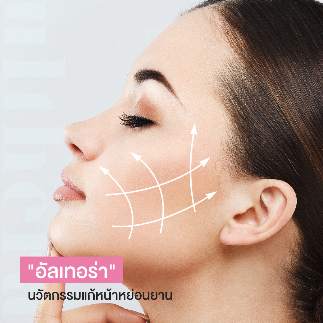 “อัลเทอร่า” Ulthera นวัตกรรมแก้ปัญหาผิวหน้าหย่อน ช่วยผ่อนเหนียง