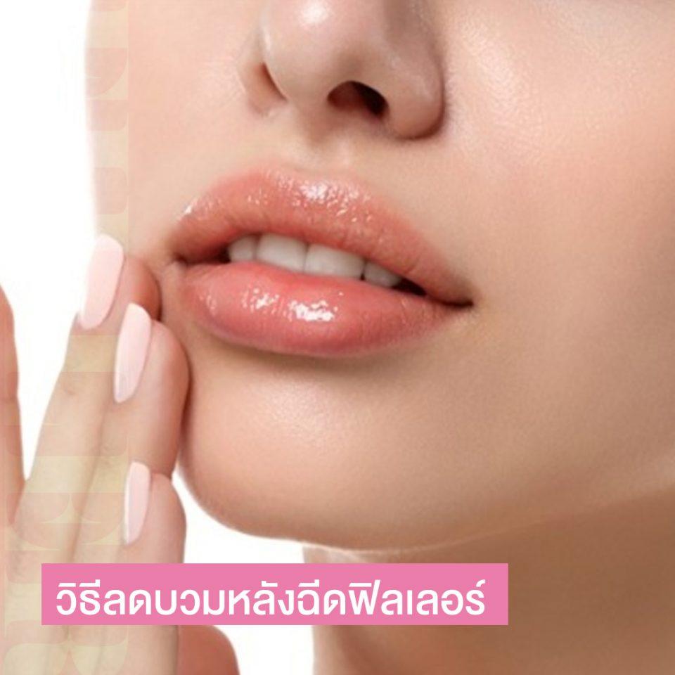 วิธีลดบวมช้ำ หลังฉีดฟิลเลอร์ ให้สวย เข้าที่เร็ว