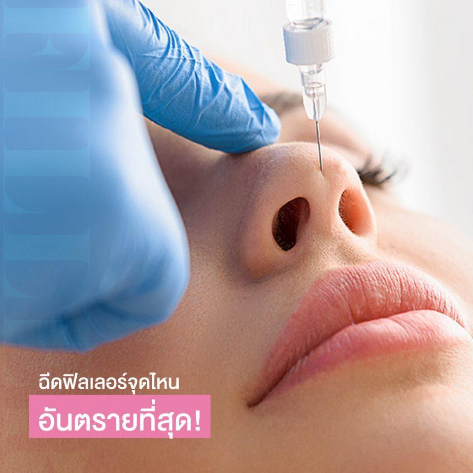 4 จุดฉีดฟิลเลอร์ อันตราย ก่อนฉีดต้องคิดให้หนัก!
