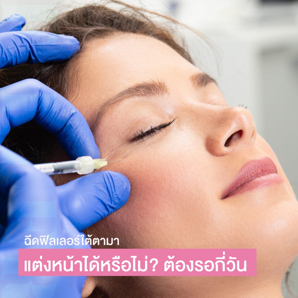 ฉีดฟิลเลอร์ใต้ตา แต่งหน้าได้หรือไม่? ทาครีมได้มั้ย ต้องรอกี่วัน