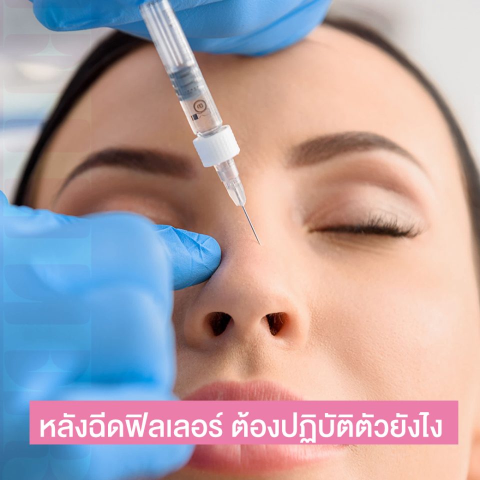 วิธีดูแลตัวเอง หลังฉีดฟิลเลอร์ ใน 24 ชั่วโมง ต้องทำตัวยังไง