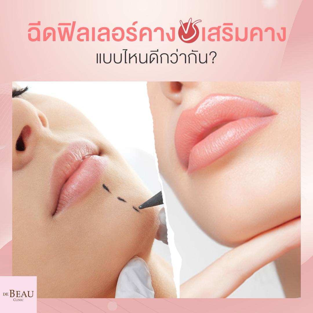 ฉีดฟิลเลอร์คาง VS เสริมคาง แบบไหนดีกว่ากัน