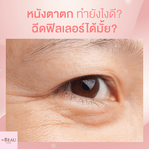 หนังตาตกทำอย่างไรดี แก้ด้วยการฉีดฟิลเลอร์ได้หรือไม่?