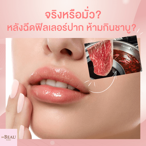 จริงหรือมั่ว?  หลังฉีดฟิลเลอร์ปากห้ามกินชาบู?