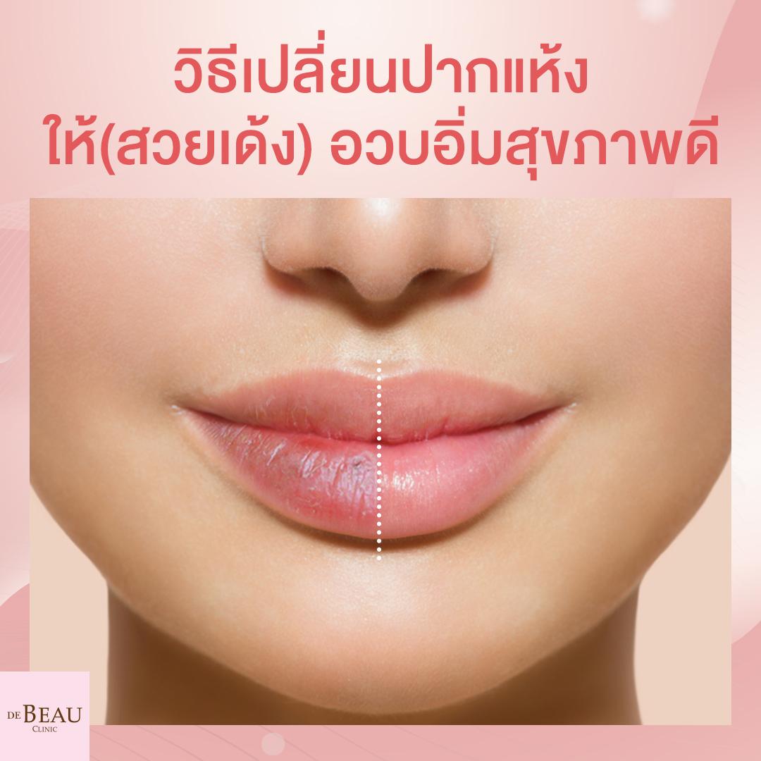 เปลี่ยนปากแห้งให้สวย ริมฝีปากอวบอิ่มสุขภาพดี ด้วยวิธีง่าย ๆ