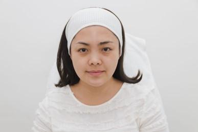 Review ฟิลเลอร์ใต้ตา คุณเอมี่ BY DE BEAU CLINIC