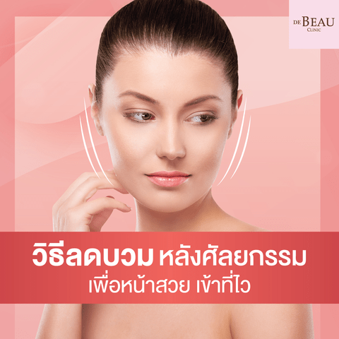 วิธีลดบวมหลังศัลยกรรม เพื่อหน้าสวยเข้าที่ไว