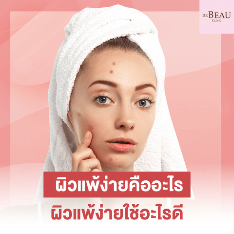 ผิวแพ้ง่ายคืออะไร ผิวแพ้ง่ายใช้อะไรดี