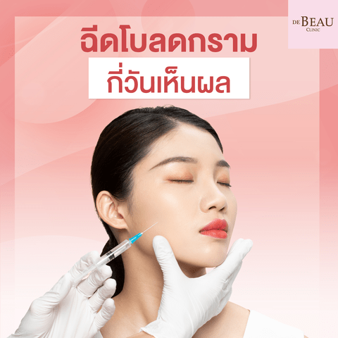 อยากฉีดโบท็อกซ์ (Botox) ฉีดโบลดกราม กี่วันเห็นผล