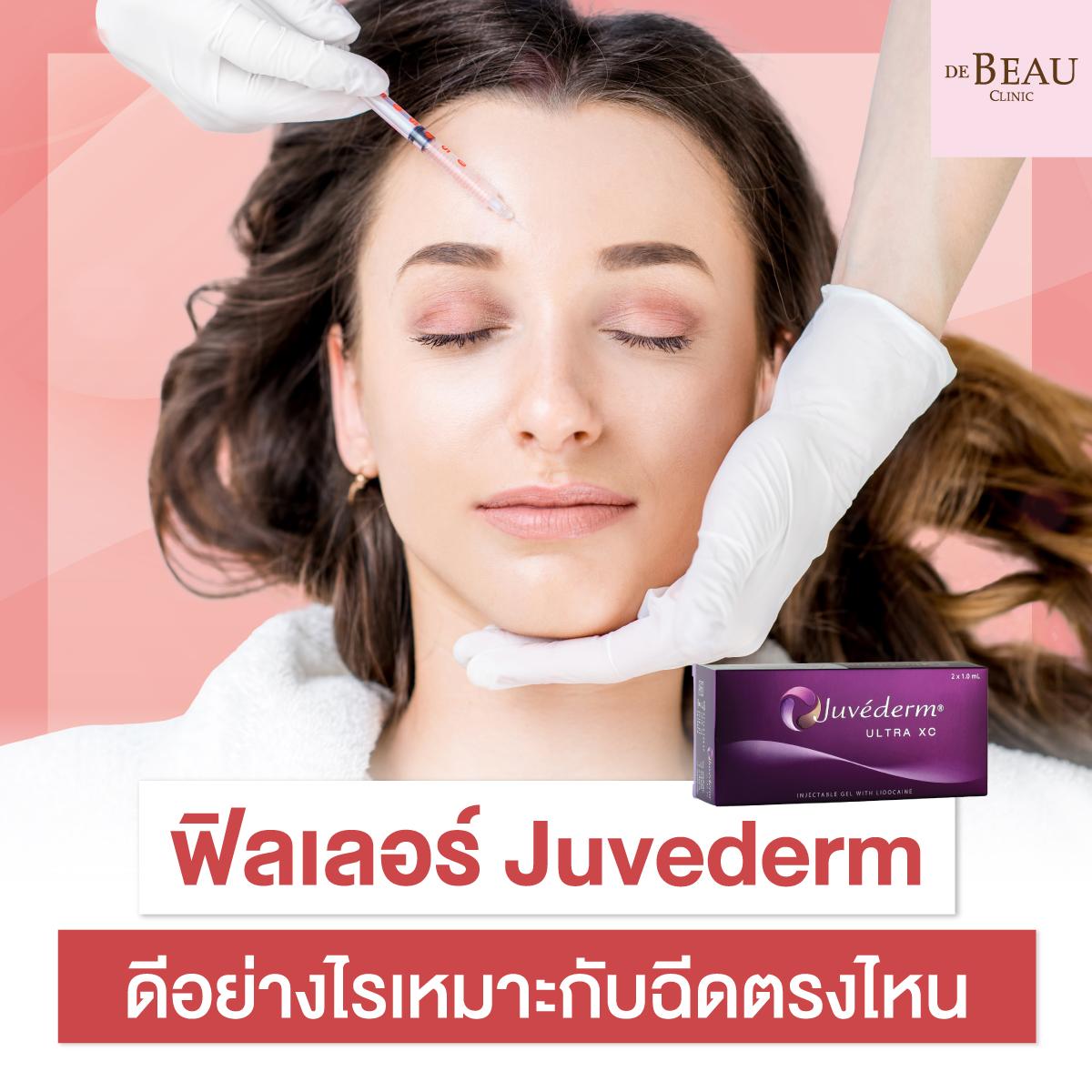 ฟิลเลอร์ juvederm ดีอย่างไร เหมาะกับฉีดตรงไหน