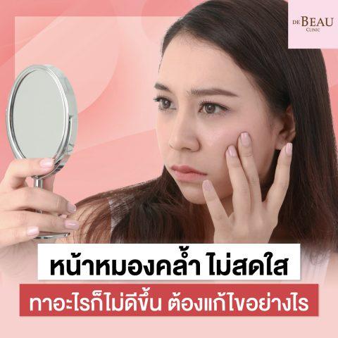 หน้าหมองคล้ำ ไม่สดใส ทาอะไรก็ไม่ดีขึ้น ต้องแก้ไขอย่างไร