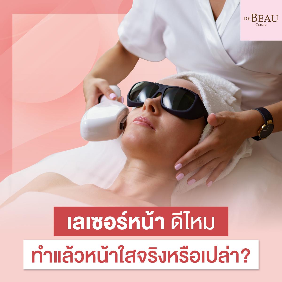 เลเซอร์หน้า ดีไหม ทำแล้วหน้าใสจริงหรือเปล่า?