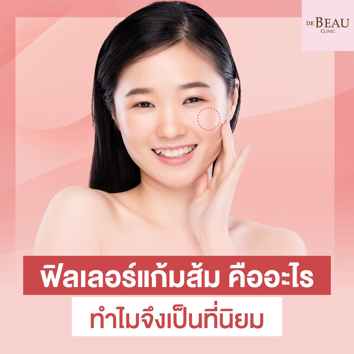 ฟิลเลอร์แก้มส้ม คืออะไร ทำไมจึงเป็นที่นิยม