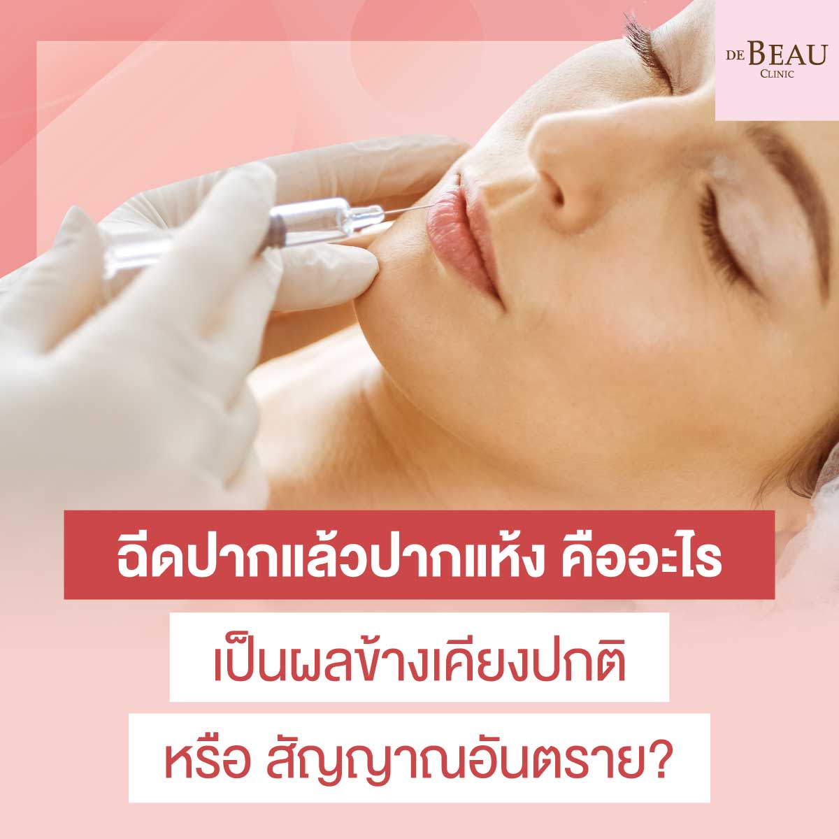 ฉีดปากแล้วปากแห้ง คืออะไร เป็นผลข้างเคียงปกติ หรือ สัญญาณอันตราย?
