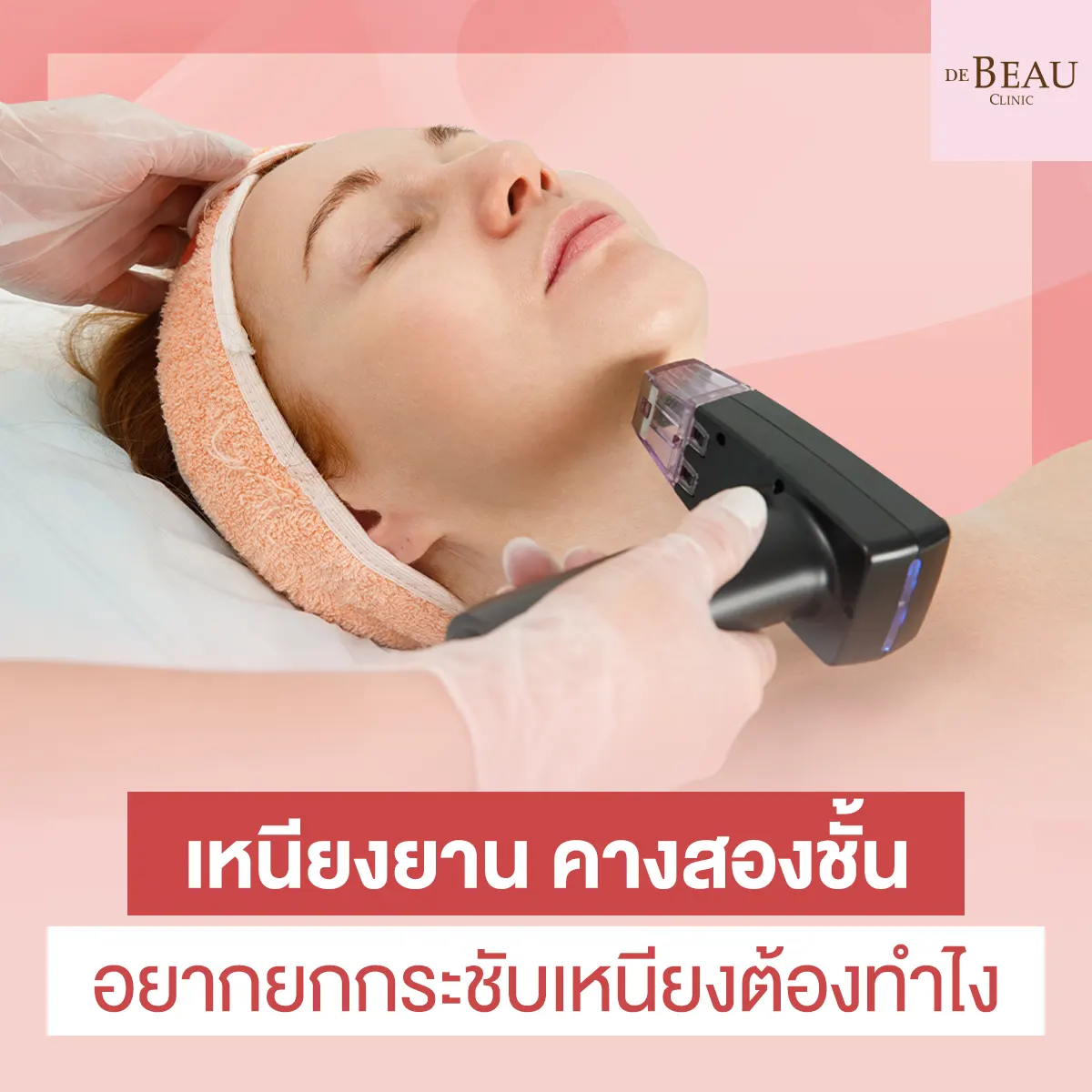 เหนียงยาน คางสองชั้น อยากยกกระชับเหนียงต้องทำไง