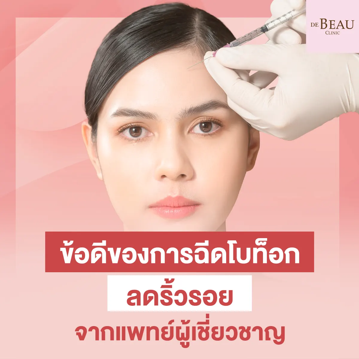 ข้อดีของการฉีดโบท็อกลดริ้วรอยจากแพทย์ผู้เชี่ยวชาญ