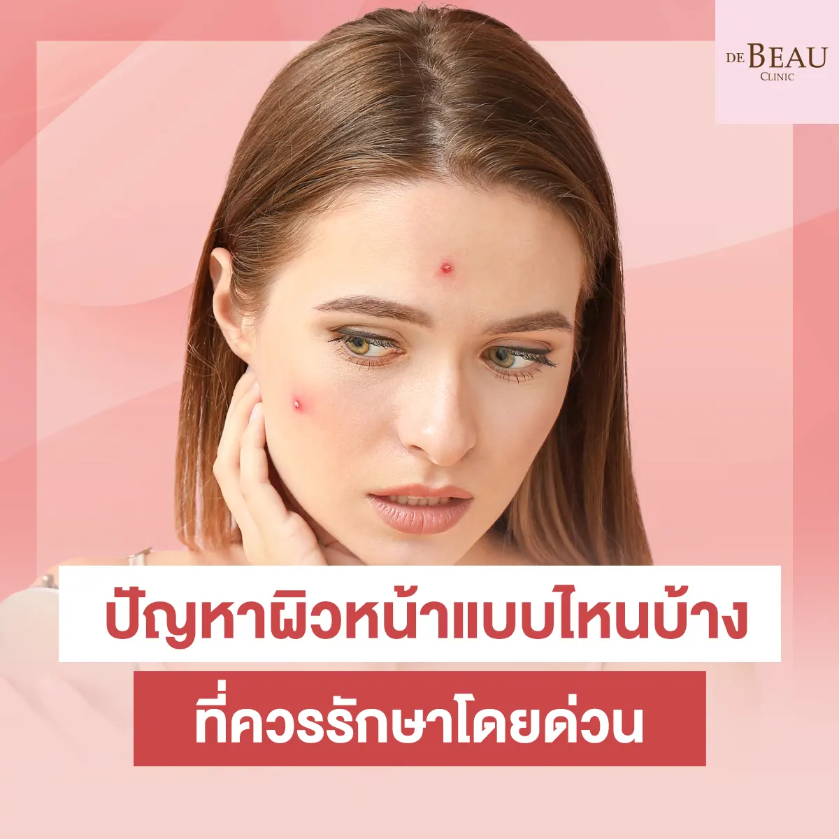 ปัญหาผิวหน้าแบบไหนบ้างที่ควรรักษาโดยด่วน