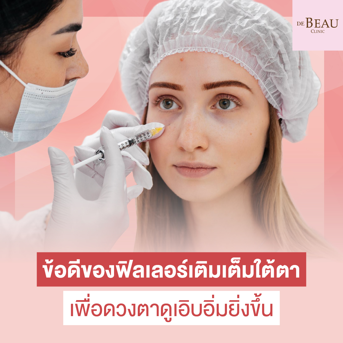 เติมเต็มใต้ตา