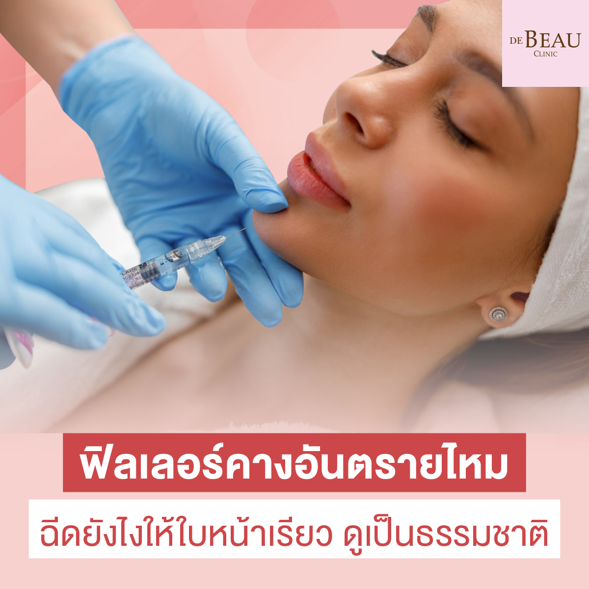 ฟิลเลอร์คางอันตรายไหม ฉีดยังไงให้ใบหน้าเรียว ดูเป็นธรรมชาติ