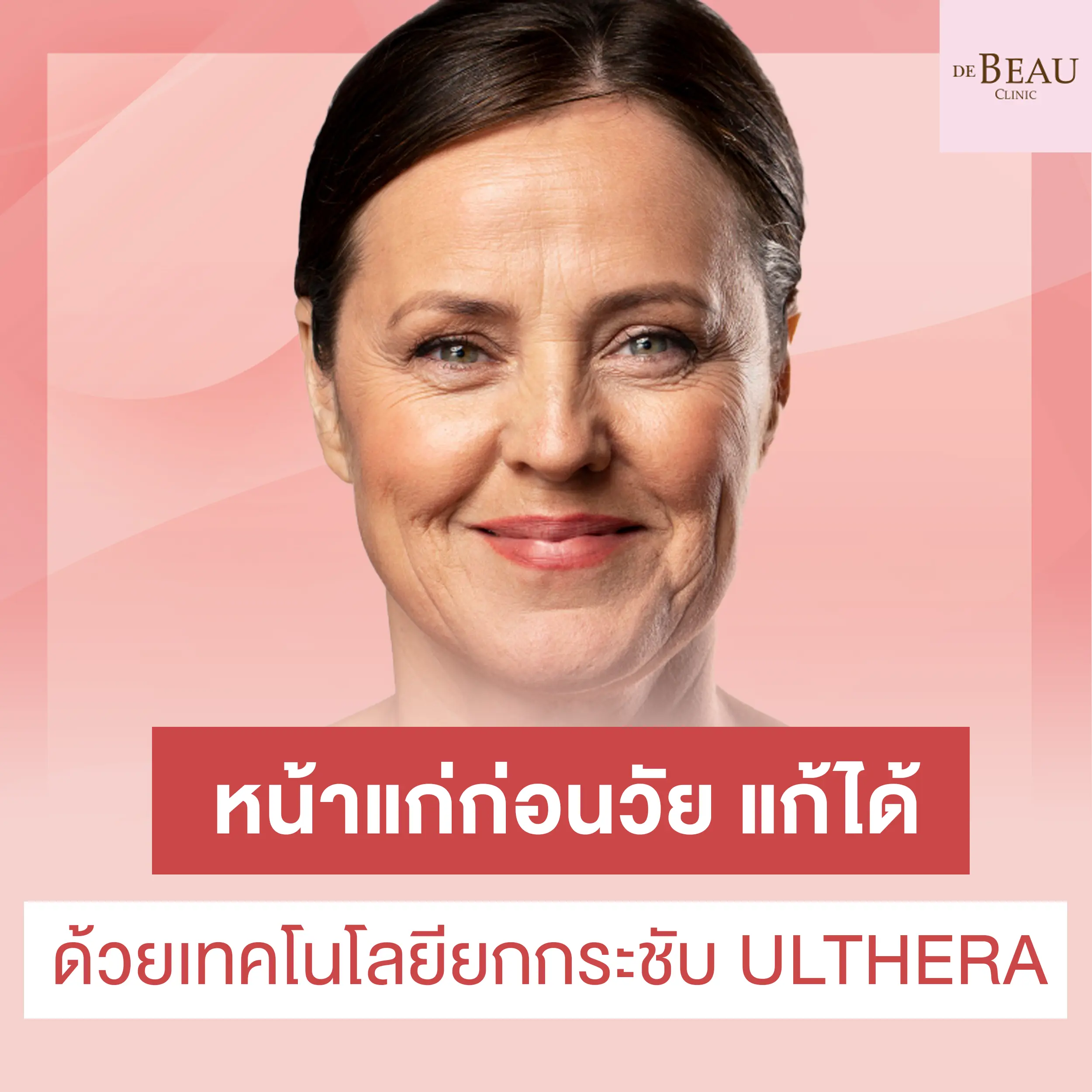 หน้าแก่ก่อนวัย แก้ได้ ด้วยเทคโนโลยียกกระชับ ULTHERA