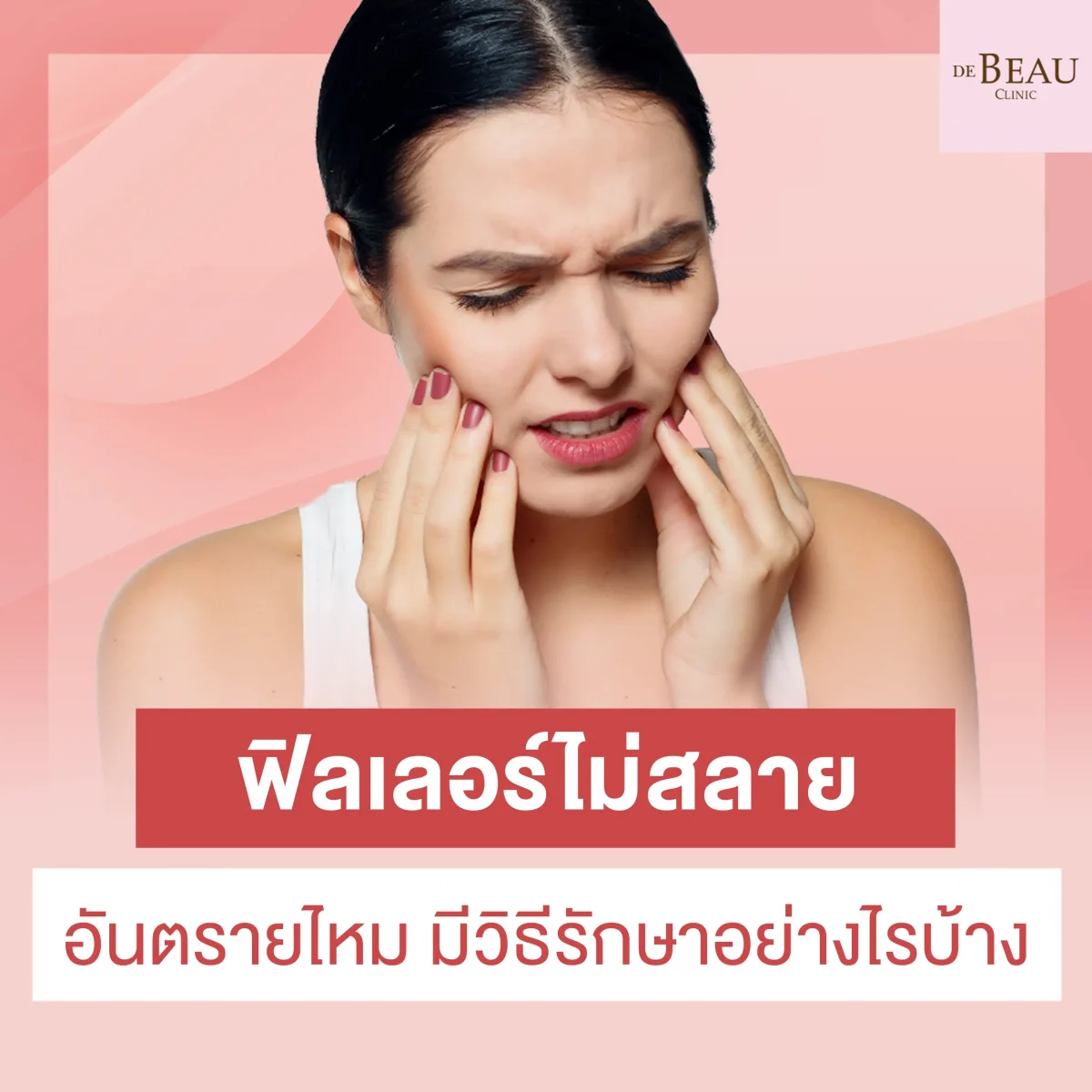 ฟิลเลอร์ไม่สลาย