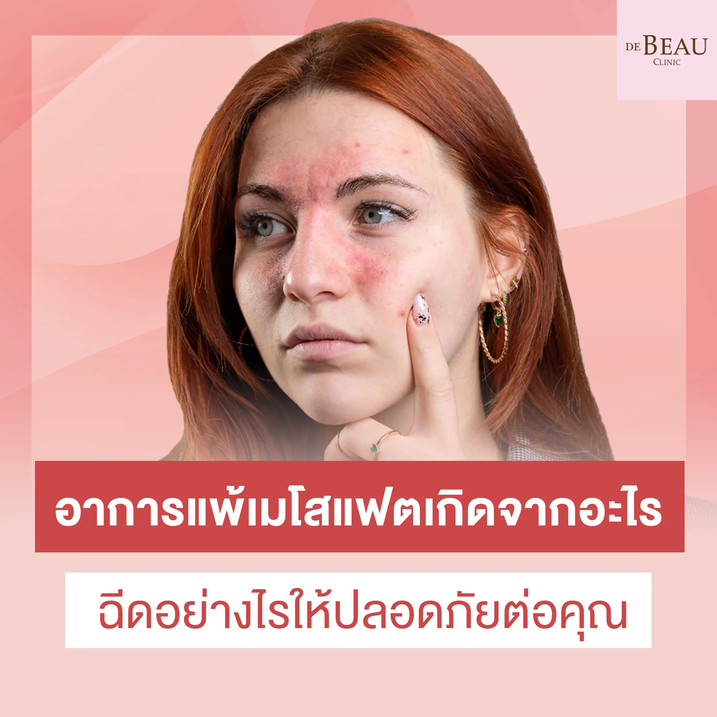 อาการแพ้เมโสแฟตเกิดจากอะไร ฉีดอย่างไรให้ปลอดภัยต่อคุณ