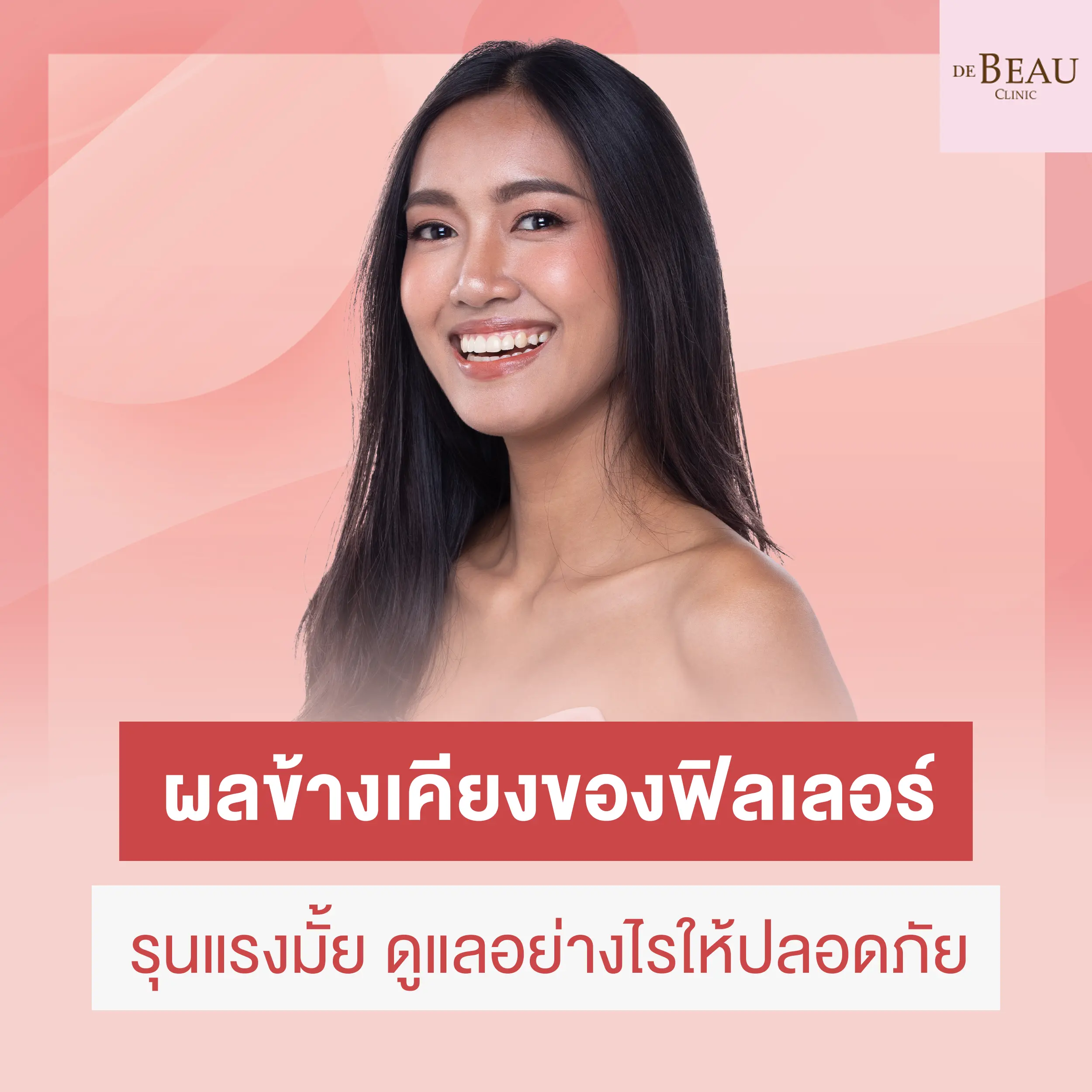 ผลข้างเคียงของฟิลเลอร์