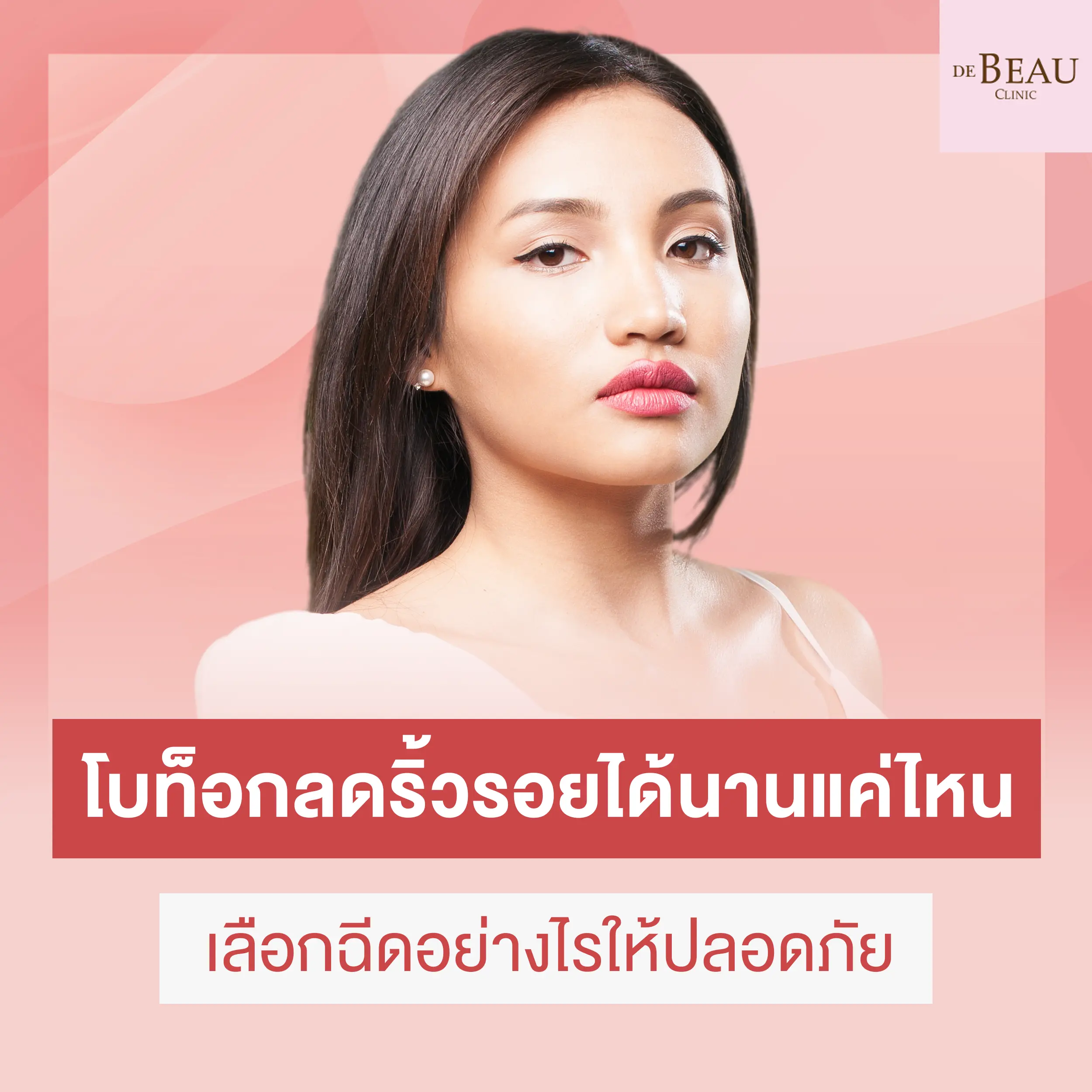 โบท็อกซ์ลดริ้วรอย