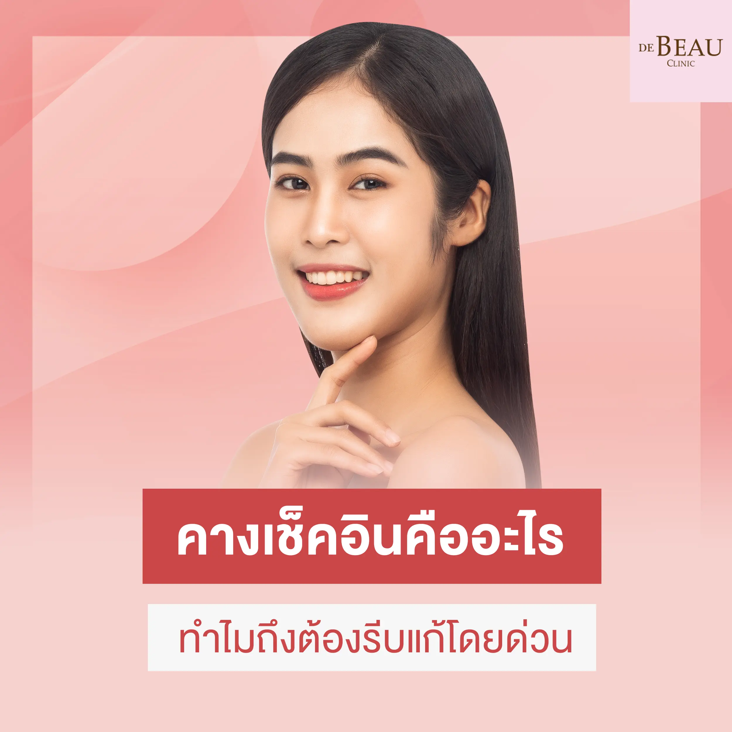 คางเช็คอินคืออะไร ทำไมถึงต้องรีบแก้โดยด่วน
