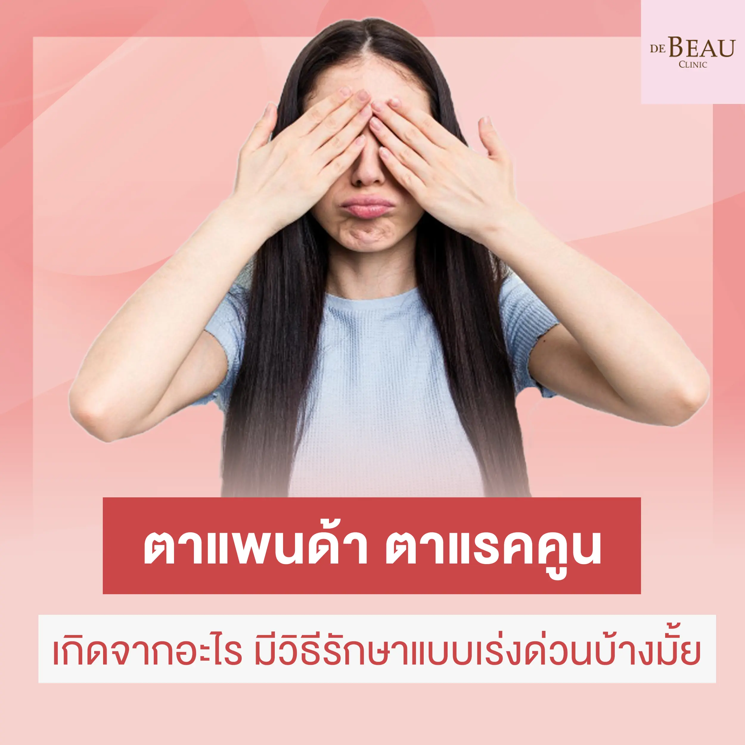 ตาแพนด้า ตาแรคคูน เกิดจากอะไร มีวิธีรักษาแบบเร่งด่วนบ้างมั้ย