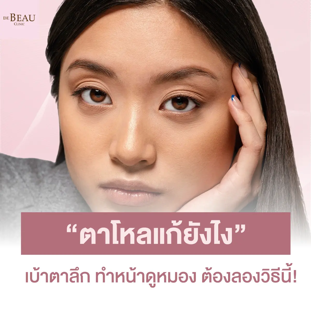 ตาโหล แก้ยังไง เบ้าตาลึก ทำหน้าดูหมอง ต้องลองวิธีนี้!