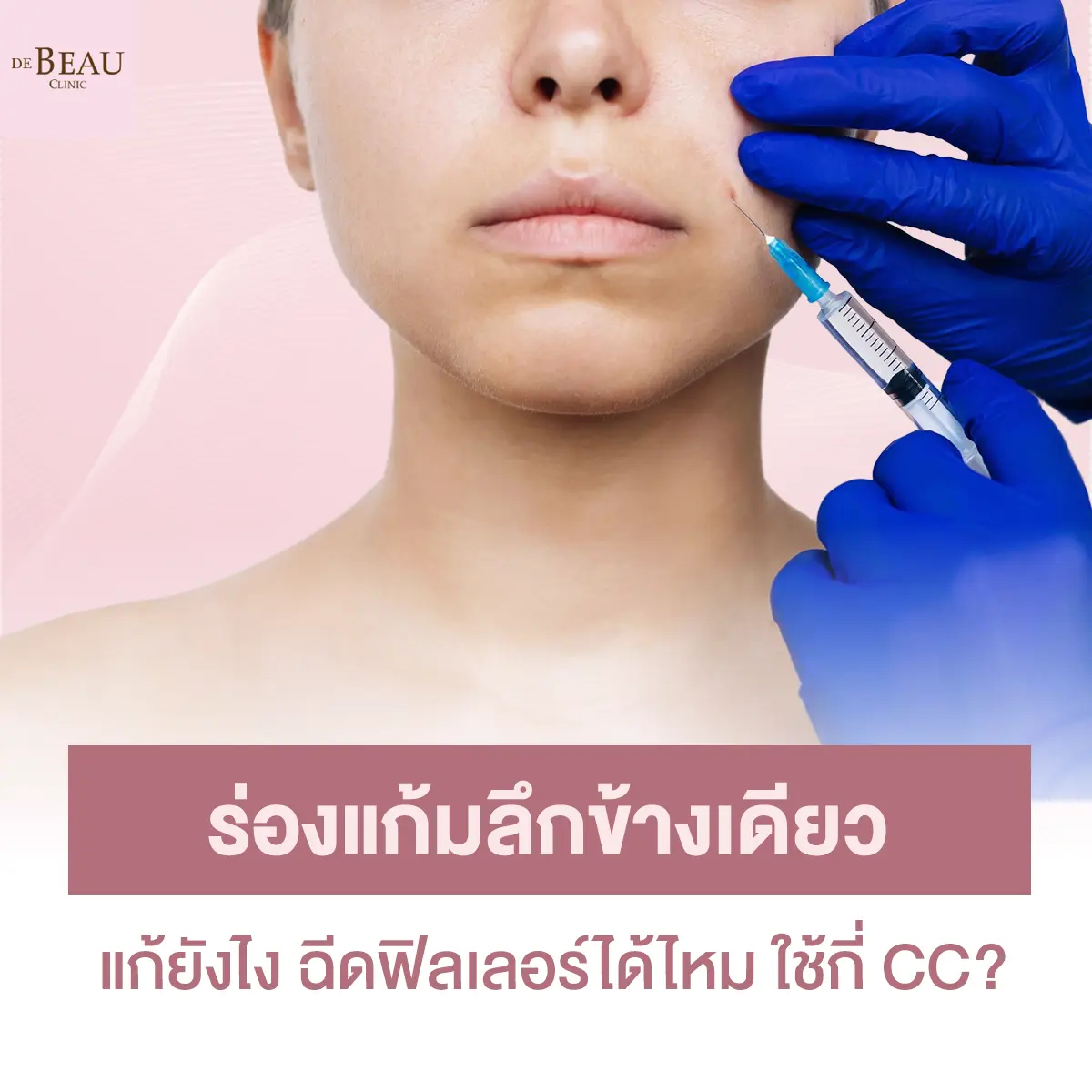 ร่องแก้มลึกข้างเดียว แก้ยังไง ฉีดฟิลเลอร์ได้ไหม ใช้กี่ CC?